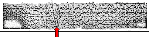 Graph showing seismic waves reflected at a wide angle from the Moho