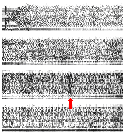 Strong reflected energy from the Moho near Mildura